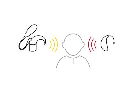 Tegning af ReSound Cochlear bimodal løsning.