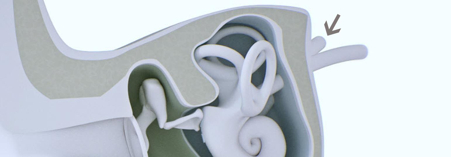 The auditory nerve.