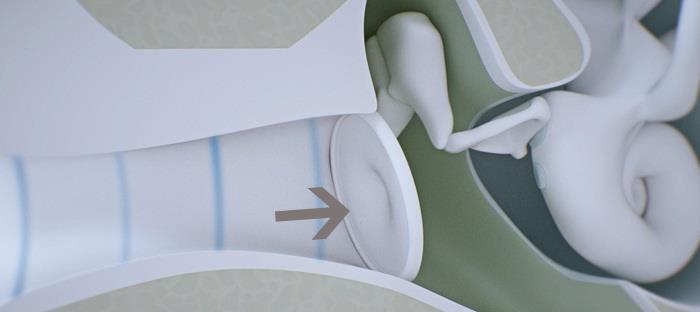 Ear drum.
