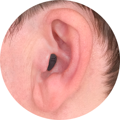 CIC