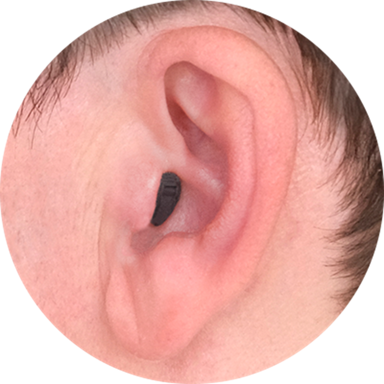 CIC